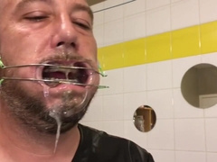 Horny Deepthroat Full Of Spit With Braces And Double Headgear