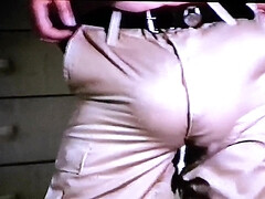 Bulging in my shinos