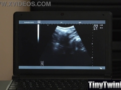 A Willing Fucktoy with Whom He Could Have fun Medic With! - Tinytwink