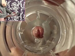 Pov, Transsexuelle