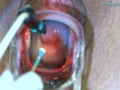 Amateur, Rubia, Loco, Médico, Examen, Fetiche, Ginecologo, Flaco