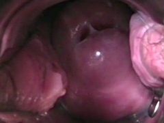 チェコ, 婦人科, インド人, 挿入, オナニー, オーガズム, 妻