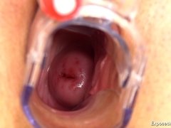 茶髪の, オナニー, 看護婦, オマンコ, 一人, おもちゃ