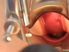 Amateur, Médecin, Exam, Fétiche, Doigter, Gyneco, Jouets