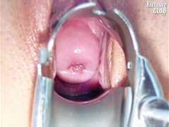 Bdsm, Doctor, Exam, Gyno