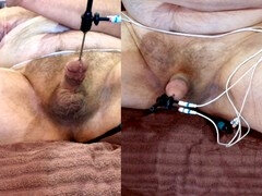 Homosexuelle, Prostate