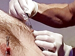 Nipples
