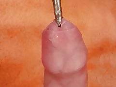 Urethral Sounding