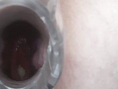 Speculum inside
