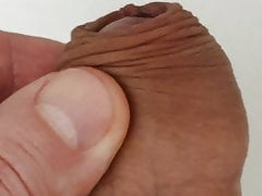 Foreskin