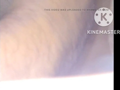 Complications my trunk