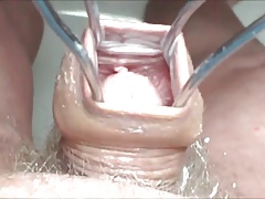 Creamy foreskin - 5 videos
