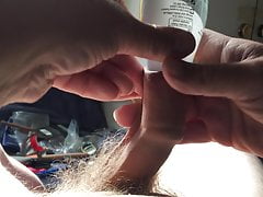 Sunshine foreskin - 7 of 8