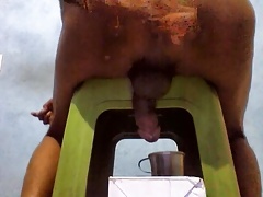 Prostate Milking in Patna