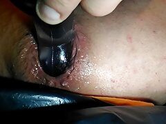 dildo fist anal dilate prolapsus anal