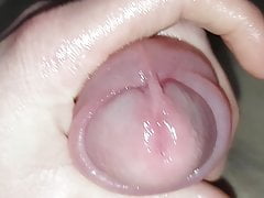 Penis pun o after one hour