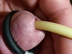 Electrocum around 22 Fr Catheter