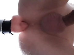anal
