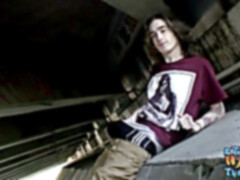 Lads, congenital, outdoors