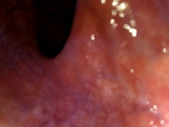 POINT OF VIEW: Wedging you in and pulling you deeper