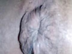 My cauliflower asshole