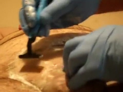 Pre-catheter shave. two