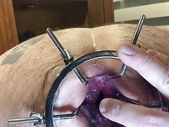 Fire281 uses the Spreader on me, great Gape attained.  Barebacked and fisted too.  Nearly a double but not quite