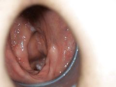 Extremely deep insights into my rectum!