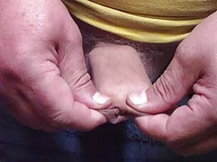 Foreskin with soap bar