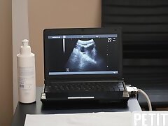 Petite twink assfingered by doctor during ultrasound