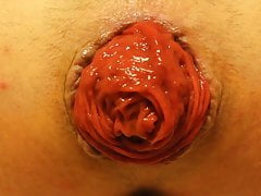 Prolapse Acting