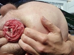 Bizzarre insertion, gay prolapse, strange insertion