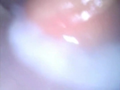 Deep look inside cum filled ass with endoscope