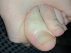 Scorching Man's Marvelous Grubby Soles