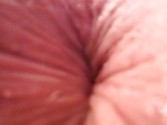 Other ass hole of mine