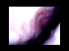 endoscope in diapason urethra insertion ejac