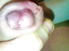 Foreskin retraction