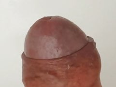 Foreskin