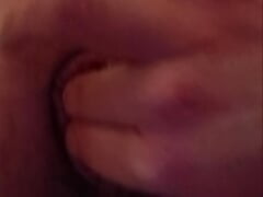 Fingering prolapse