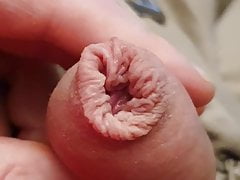 Foreskin