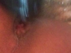 Anal gaping clip 2