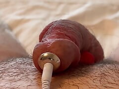 Prostate Electrojaculation Estim