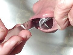 Foreskin with scissors and plastic lid