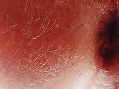 Close Up of my destroyed asshole.