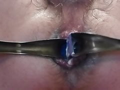 hole stretching