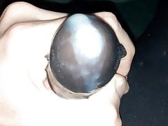 Nylon sock cum eruption aftermath