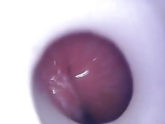 Internal cum