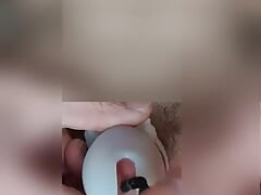 Use dilator despite penis cage