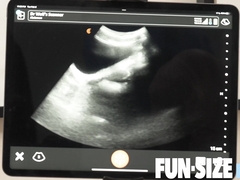 FunSizeBoys Grant Ducati and Dr Legrand Bear ultrasound romp sequence