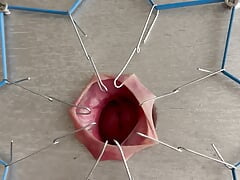 Foreskin torture